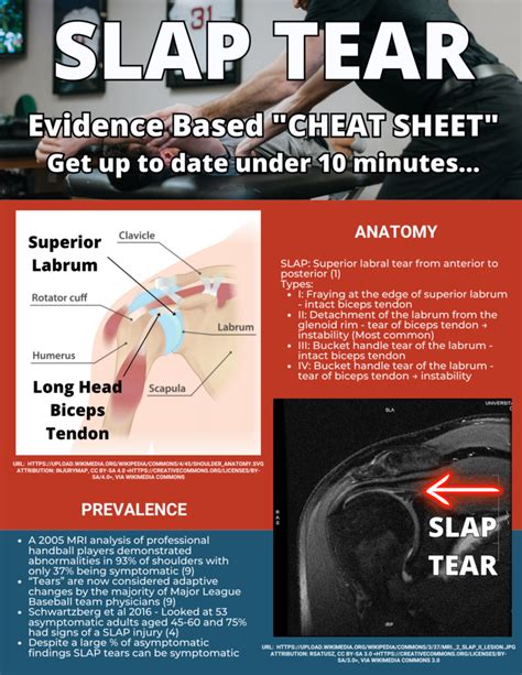 slap tear positive test|slap tear explained.